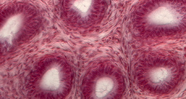 Presjek sjemenskih kanalića