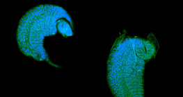 Larva ichneumon ose, razvija se kao parazit u kukuljici vinske mušlice