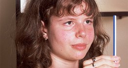 Prilagodba oka na različite udaljenosti fokusa