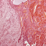 Hipofiza (uzdužni presjek, fotografija sa malim uvećanjem)