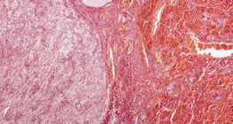 Hipofiza (uzdužni presjek, fotografija sa malim uvećanjem)