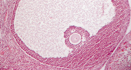 Poprečni presjek jajnika (sisavci)