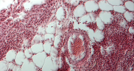 Presjek kroz ljudska pluća