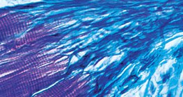 Veza između mišića i tetive