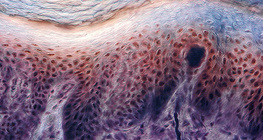 Poprečni presjek kože ljudskog prsta sa receptorima