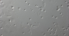 Krvne stanice larve vinske mušice