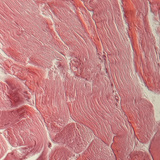 Tetiva (poprečni presjek)