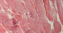 Tetiva (poprečni presjek)