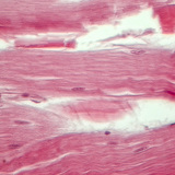 Tetiva (uzdužni presjek)