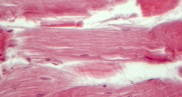 Tetiva (uzdužni presjek)