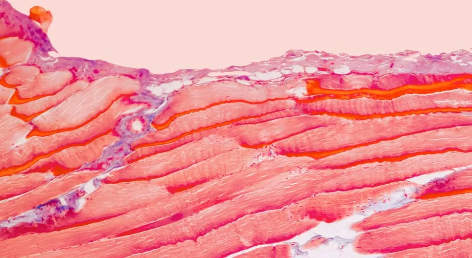 Od kojih su tkiva izgrađeni mišići?