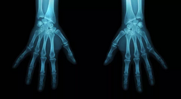 Postani forenzični antropolog!