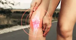 Osteoarthritis