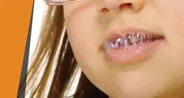 'Corrosive' saliva